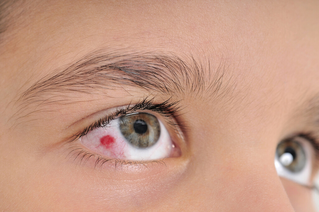 Механическая травма глаза: первая помощь