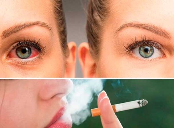 Как курение влияет на здоровье глаз?